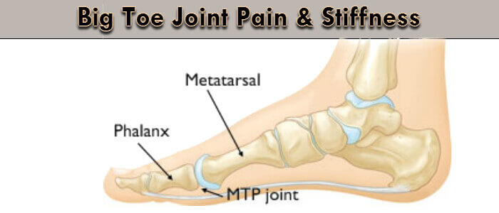 https://www.londonfootandanklesurgery.co.uk/wp-content/uploads/2015/06/big-toe-pain.jpg