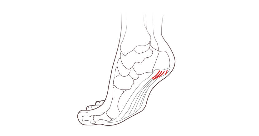 Heel Pain Treatment Clinic in London 