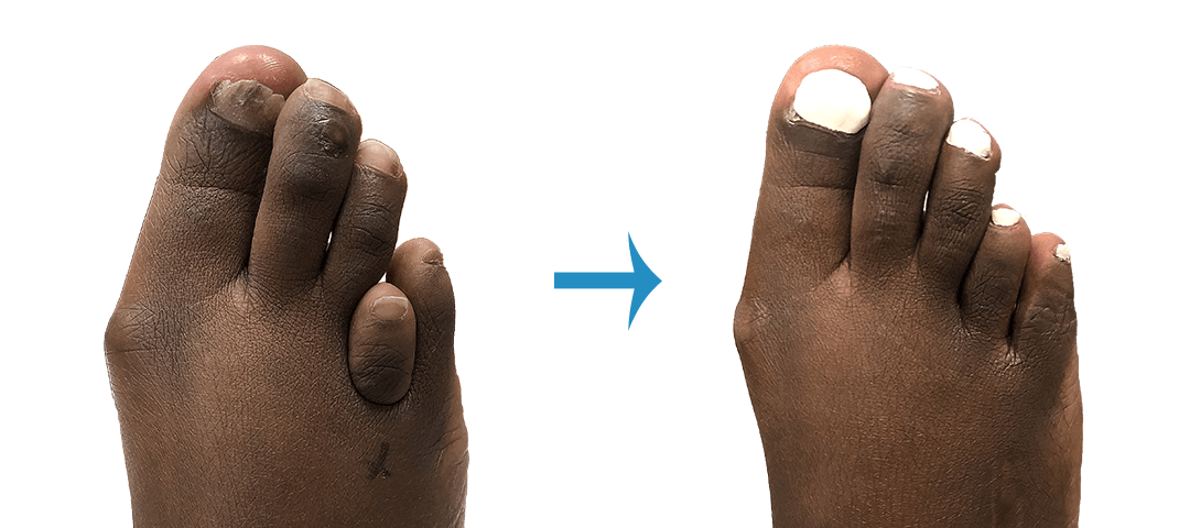 Feet And Toes Galleries