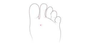 Corn Removal Surgery