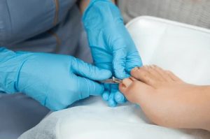 Surgical treatment for ingrown toenail treatment for ingrown toenail