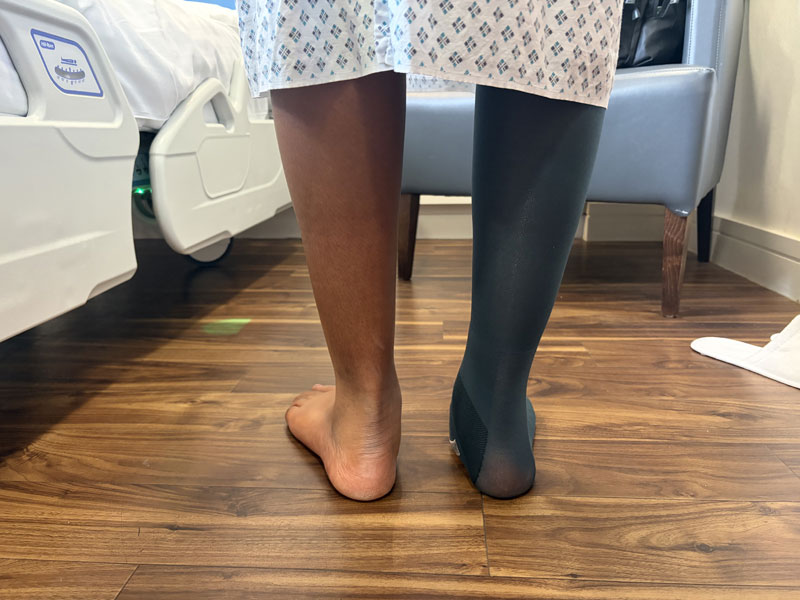 Can Flat Feet Cause Knee and Lower Back Pain? Can Flat Feet Cause Knee and Lower Back Pain?